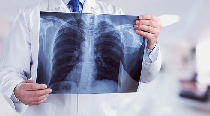 مختص في الأمراض الصدرية والحساسية لـ«الصباح»:   كل الأدوية والتلاقيح متوفّرة.. و«الكنام» يتكفّل بتكاليف العلاج